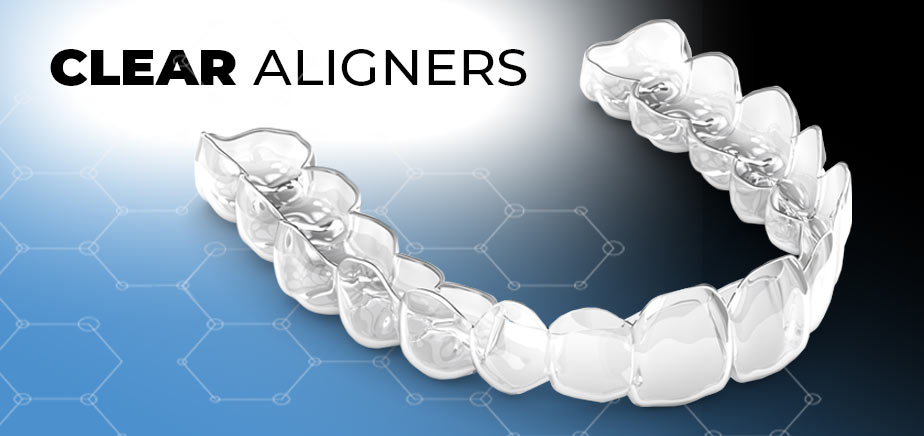 ALIGNERS.jpg